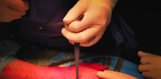 DEEPHO: fuori il singolo “DITA COTTE”