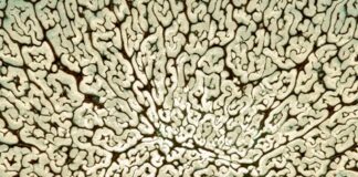 Fuori il nuovo album “Radeche Fonne” di Matteo Stella